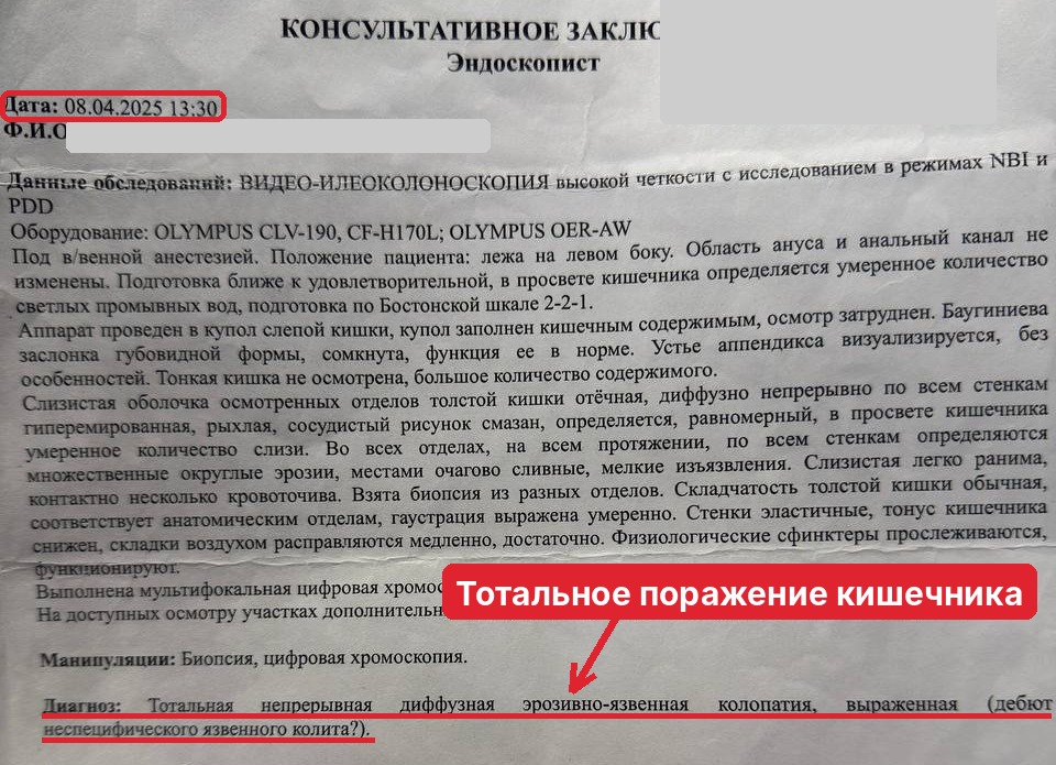 колоноскопия 08.04.2025: «тотальная… эрозивно-язвенная колопатия