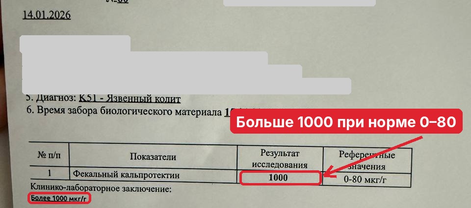 Мой кальпротектин: тогда и сейчас.