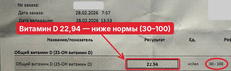 витамин D 22,94 при норме 30–100
