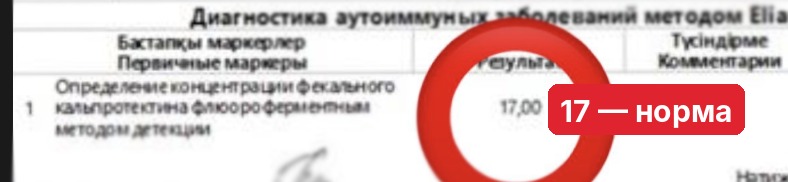 Мой кальпротектин: тогда и сейчас.