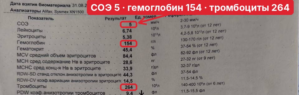 Скриншот анализа