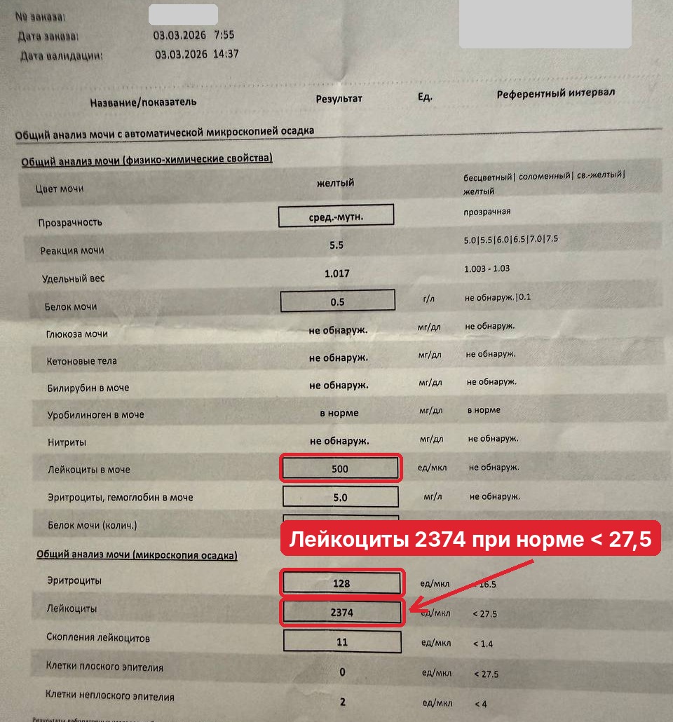 Скриншот анализа